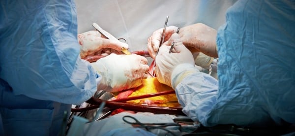 Hands of surgeon team performing operation at cardiology surgery clinic