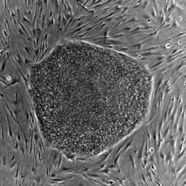 Έρευνα στα βλαστοκύτταρα: Μία προσέγγιση με βάση την ορθόδοξη βιοηθική
