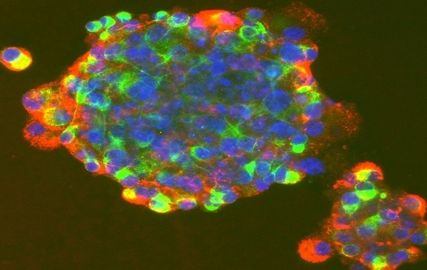 Bλαστοκύτταρα – Χρήσεις και Βιοηθικοί Προβληματισμοί [1]