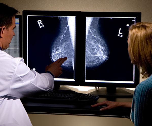 Μαστογραφία: απαραίτητη μία φορά το χρόνο στις γυναίκες άνω των 40