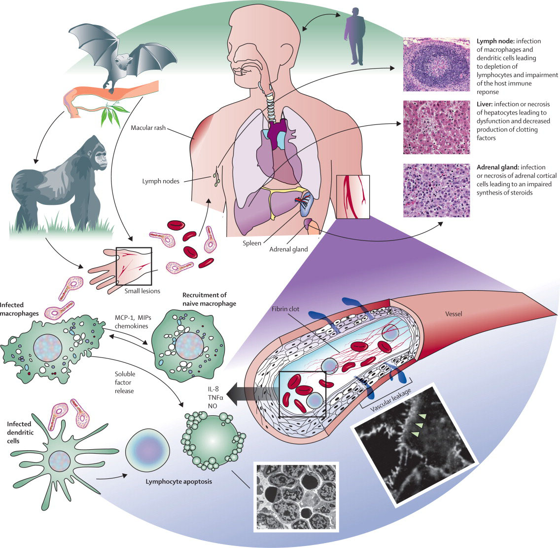 Ebola-virus-pathogenesis