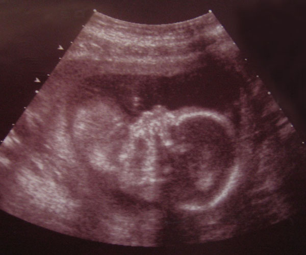Η αναπαραγωγή και το έμβρυο (Β’)