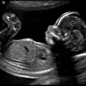 Παρεμβατική γονιμοποίηση: η ορθόδοξη ηθική αξιολόγηση (Α’)