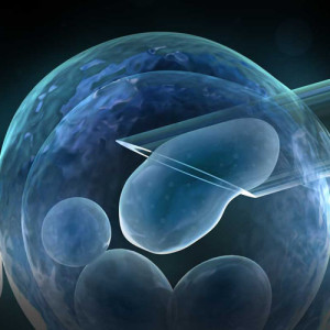 Ετερόλογη εξωσωματική γονιμοποίηση, σπερματέγχυση & Ρωμαιοκαθολική προσέγγιση