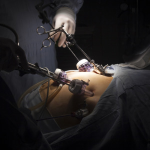 Λαπαροσκοπική χειρουργική: όταν η υγεία συναντά την οικονομία