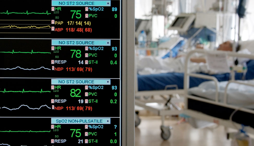 monitoring in ICU with patients