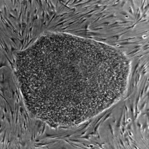 Τι είναι τα βλαστοκύτταρα;