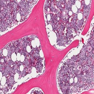 Ο μυελός των οστών ως πηγή βλαστοκυττάρων
