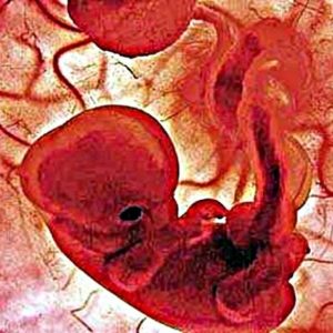 Η έκτρωση ως κοινωνικό και ηθικό πρόβλημα