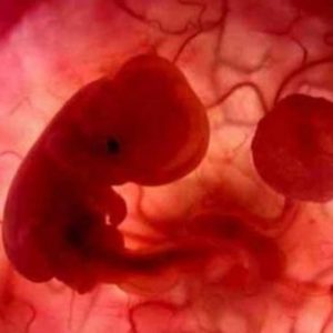 Το status του εμβρύου και η έρευνα για τη χρήση βλαστοκυττάρων από εμβρυϊκά κύτταρα